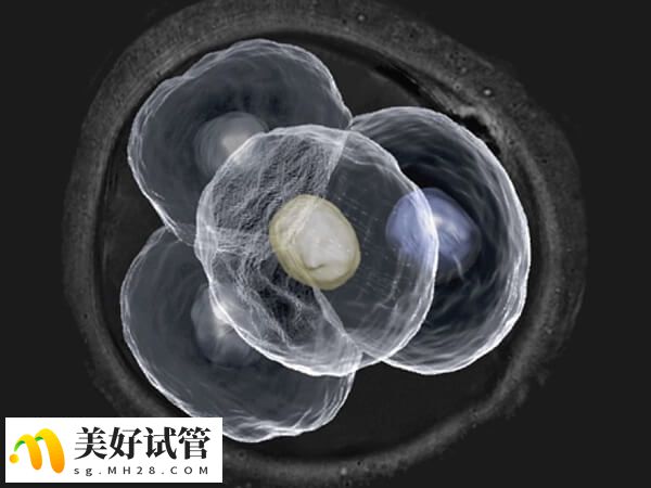 高龄试管生育风险高