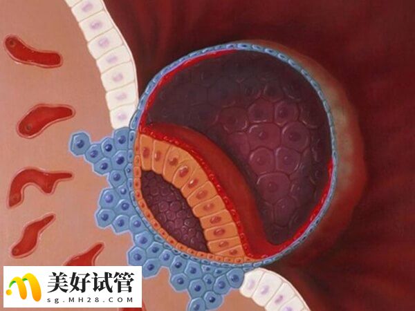 黄体功能不全可能会影响胚胎着床
