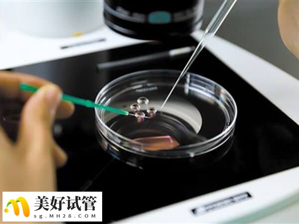 精子活力低采用精液分离术能提高受精率