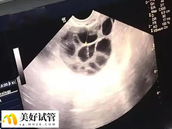 打促排针卵泡长得慢要及时就医