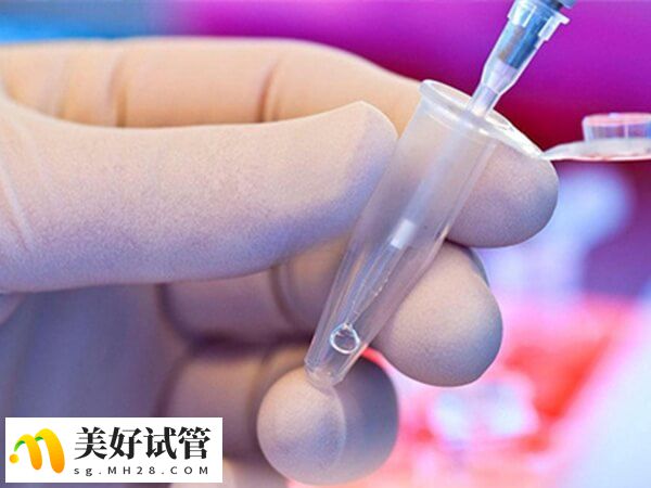 促排和取卵这两个步骤疼痛最强