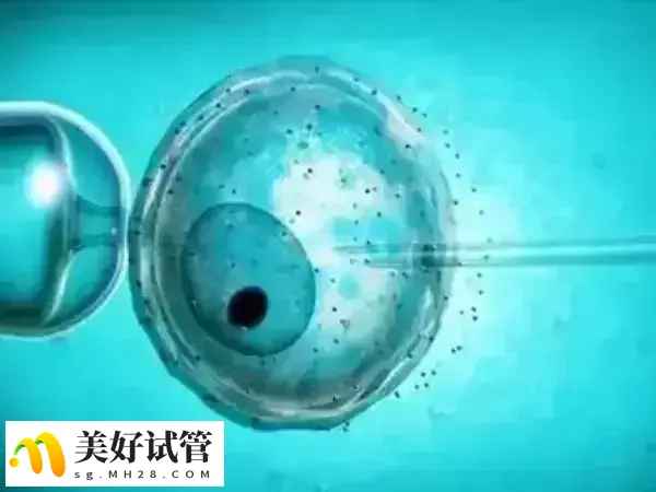 二代试管采用的是单精子卵胞浆内注射术