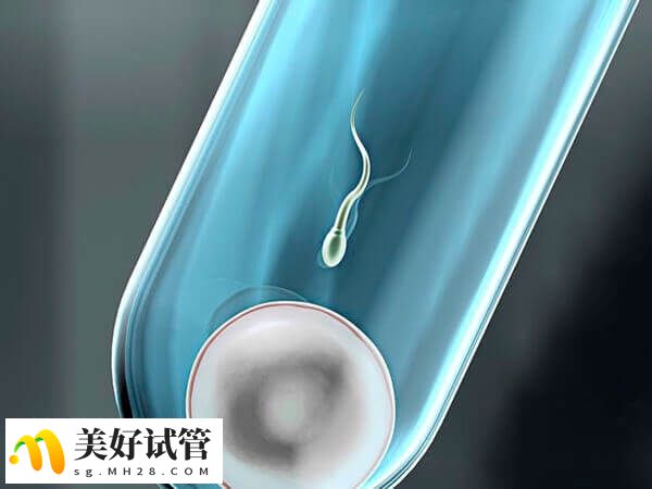 女性年龄是双胎移植的重要参考条件之一