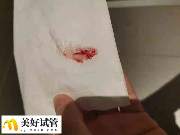 试管移植后出血可能是着床出血
